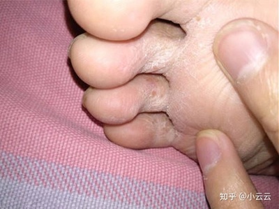 鞋子特别臭怎么办