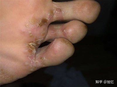 鞋子特别臭怎么办